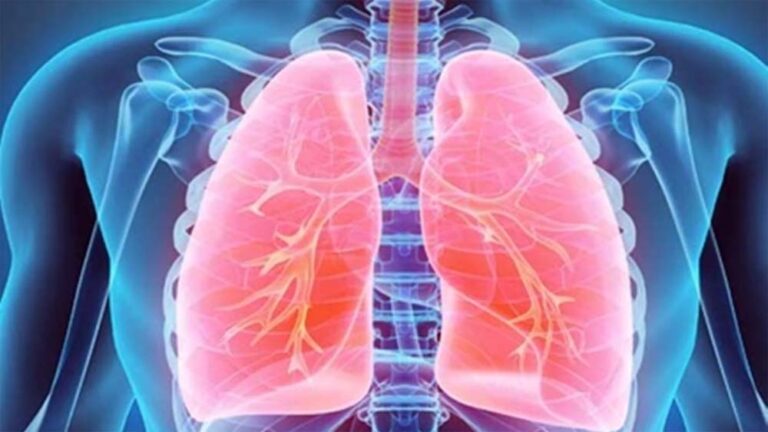 मध्य प्रदेश में टीबी इलाज की चार दवाओं में से एक उपलब्ध ही नहीं, फार्मूला तो मिला पर दवा नहीं