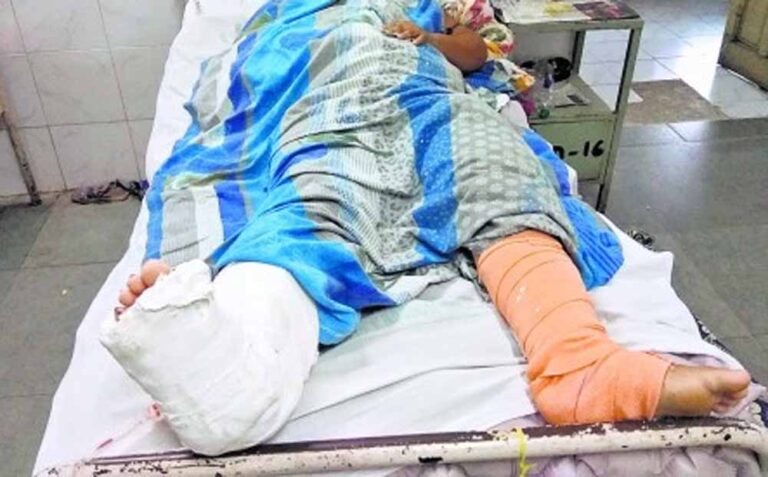 ऑपरेशन में लापरवाही! इलाज के बाद छोटा हो गया मरीज का पैर, आयोग ने दिया 3 लाख का मुआवजा