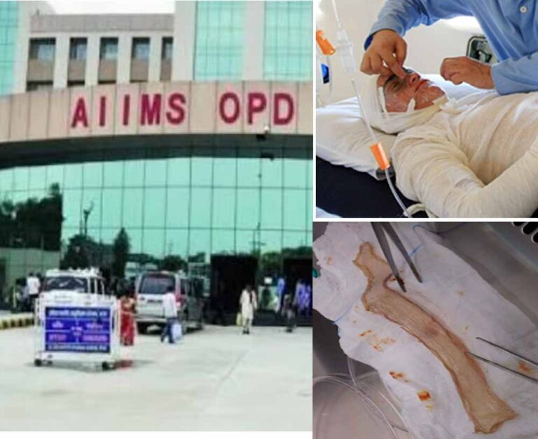 बिहार का पहला स्किन बैंक तैयार, पटना एम्स में जलने वाले मरीजों को अब मिलेगा नया जीवन