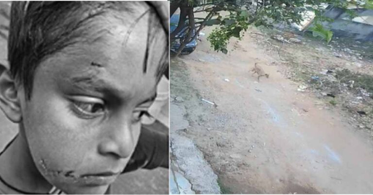 बिलासपुर में PM श्री स्कूल के अंदर कुत्ते ने पहली कक्षा के बच्चे को नोचा, बचाने दौड़ी टीचर पर भी किया हमला