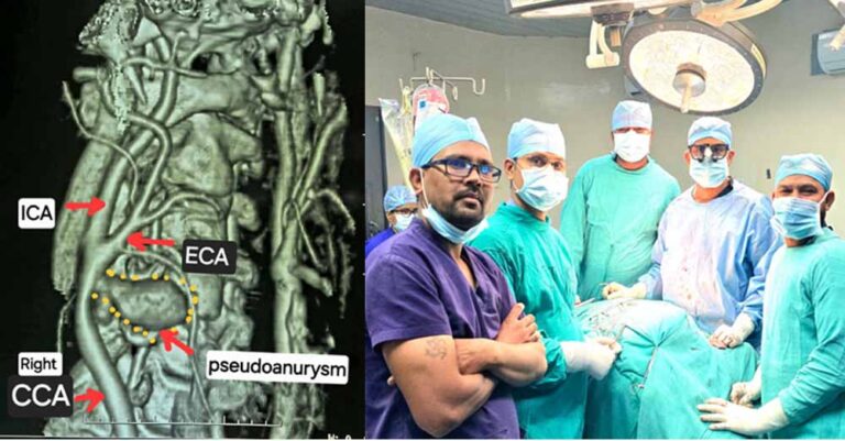छत्तीसगढ़ के मेकाहारा हॉस्पिटल के डॉक्टरों ने दी नई जिंदगी, ब्रश करते समय फटी गर्दन की नस की दुर्लभ सर्जरी की