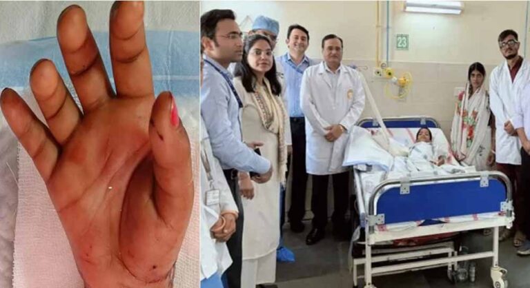डॉक्टरों ने बच्ची का कटा हाथ जोड़ा, एम्स पटना में 6 घंटे चली सर्जरी