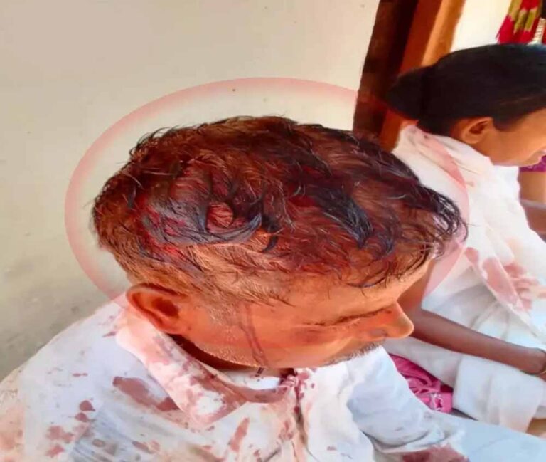 सुकमा में प्रार्थना सभा बनी रणभूमि, दो पक्षों में जमकर मारपीट, कई ग्रामीण घायल