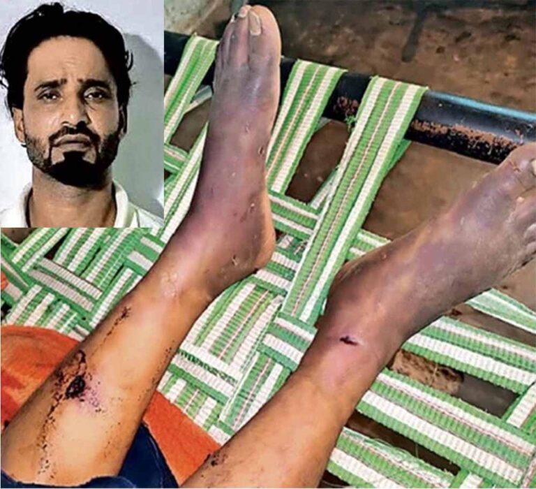ग्वालियर में इंसानियत शर्मसार: चोरी के शक में बच्ची को कीलों वाले डंडे से पीटा, आरोपी आमीन जेल भेजा गया